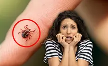 ¿Es peligrosa la picadura por garrapata? esto es lo que debes saber ¿Es peligrosa la picadura por garrapata? esto es lo que debes saber