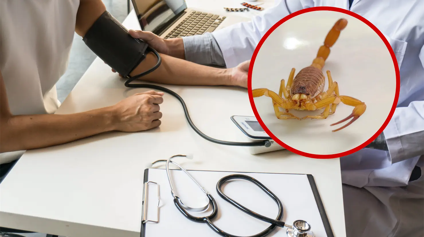 Lo primero que se debe hacer ante la picadura de un alacrán es acudir a emergencias médicas. Foto: Especial.