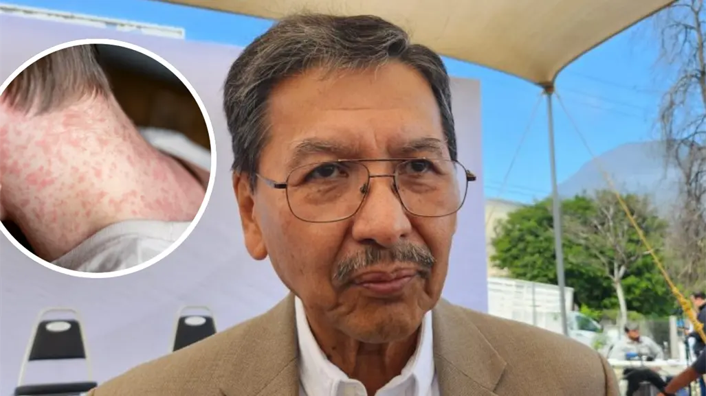 Tamaulipas se encuentra libre de sarampión según Secretaría de Salud
