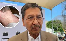 Tamaulipas se encuentra libre de sarampión según Secretaría de Salud