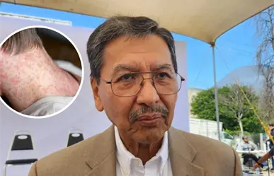 Tamaulipas se encuentra libre de sarampión según Secretaría de Salud