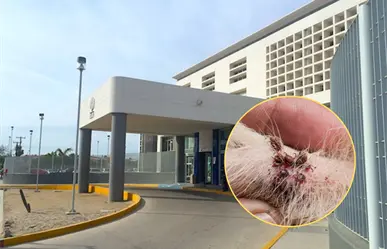 ¿Plaga de garrapatas en el ISSSTE Conchalito? Autoridades aclaran el origen del video viral