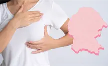 Se registran más de 150 muertes  por cáncer de mama en Coahuila durante el 2025
