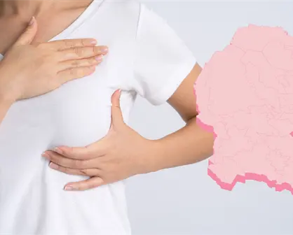 Se registran más de 150 muertes  por cáncer de mama en Coahuila durante el 2025