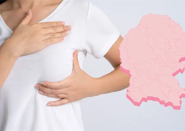 Se registran más de 150 muertes  por cáncer de mama en Coahuila durante el 2025