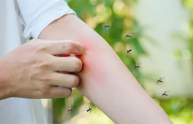 Mosquitos en Yucatán: este es el mejor repelente, según Profeco