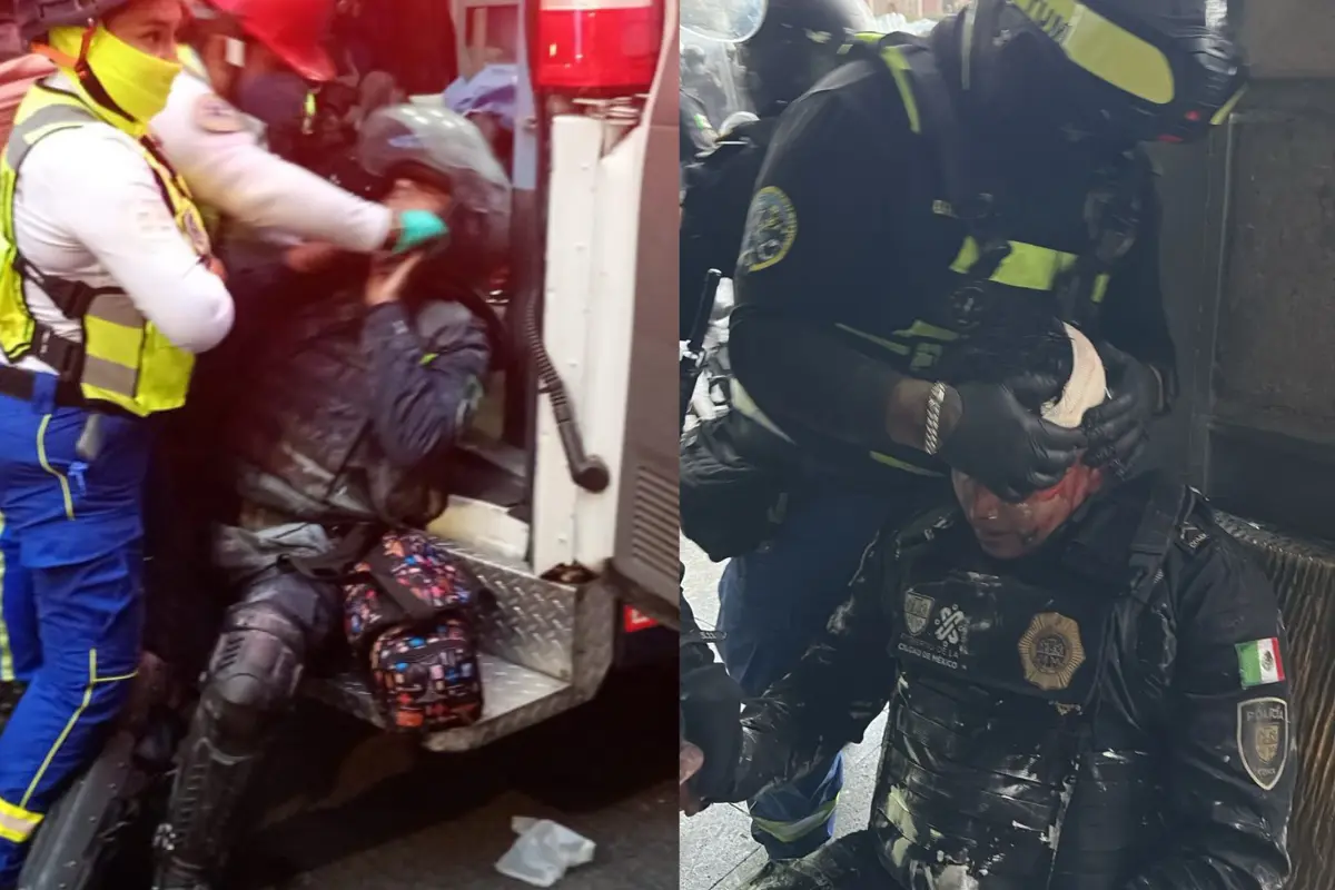 Policías siguen hospitalizados en CDMX. Foto: X @POSTACDMX