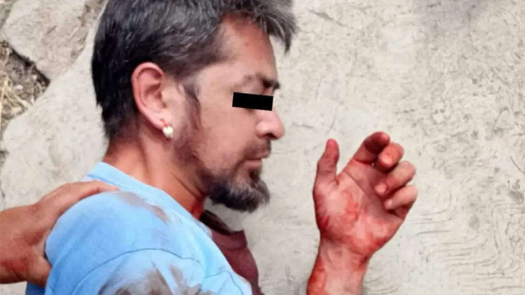 Ataca a su familia con un cuchillo en Ecatepec; estaba drogado y ebrio