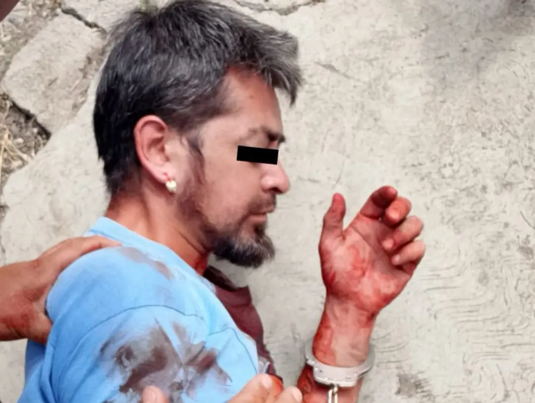 Tras un operativo policiaco en Ecatepec, el agresor fue sometido y trasladado a un hospital. Imagen: Osvaldo Müller