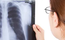 Salud activa alerta epidemiológica por 8 casos de tuberculosis en Tampico