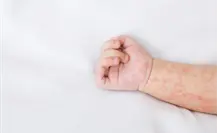 Coxsackie en Tamaulipas: ¿Qué hacer si tu hijo presenta síntomas de enfermedad de manos, pies, boca?