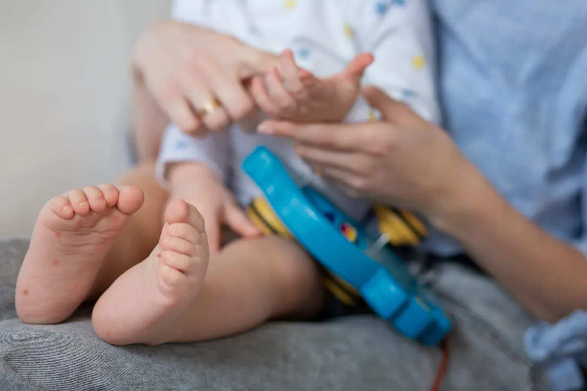 Sector Salud pide tener higiene principalmente en los más pequeños ya que el virus es contagioso | Foto: Perla Herrera