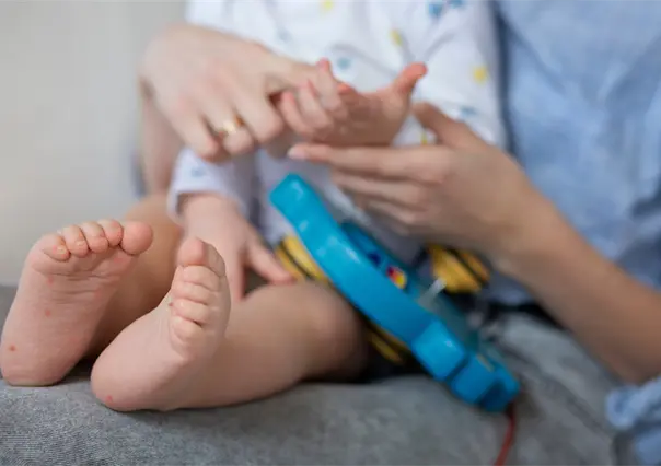 Aumentan brotes de boca-mano-pie en Tamaulipas; instan a reforzar medidas de higiene