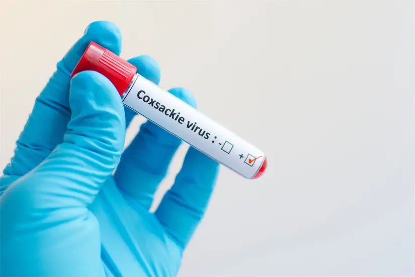 Autoridades sanitarias reiteran que no existe un tratamiento antiviral específico contra el Coxsackie, por lo que el manejo se centra en aliviar los síntomas y evitar la deshidratación. Foto: Canva