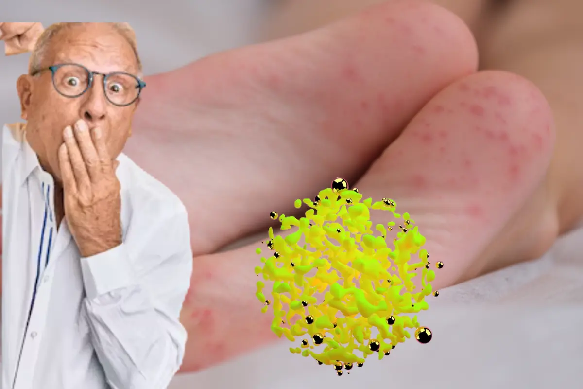 Estos son algunos datos que tal vez no sabes acerca del virus Coxsakie, averigua que dicen las autoridades de Tamaulipas