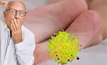 3 cosas que no sabes del Coxsackie, esto dicen las autoridades de salud en Tamaulipas