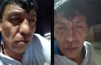 Machetean a cajita del Niño Fidencio en Monclova; resulta grave