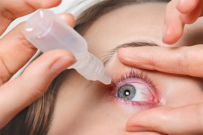 Más de 30 mil casos de conjuntivitis en Tamaulipas | Foto: Freepik