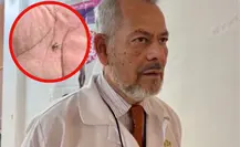 Prevé Sector Salud nuevos casos de dengue ante aumento de mosquitos en el sur de Tamaulipas