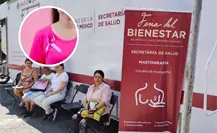 El cáncer de mama en CDMX: el reto de detectar a tiempo la principal causa de muerte en mujeres