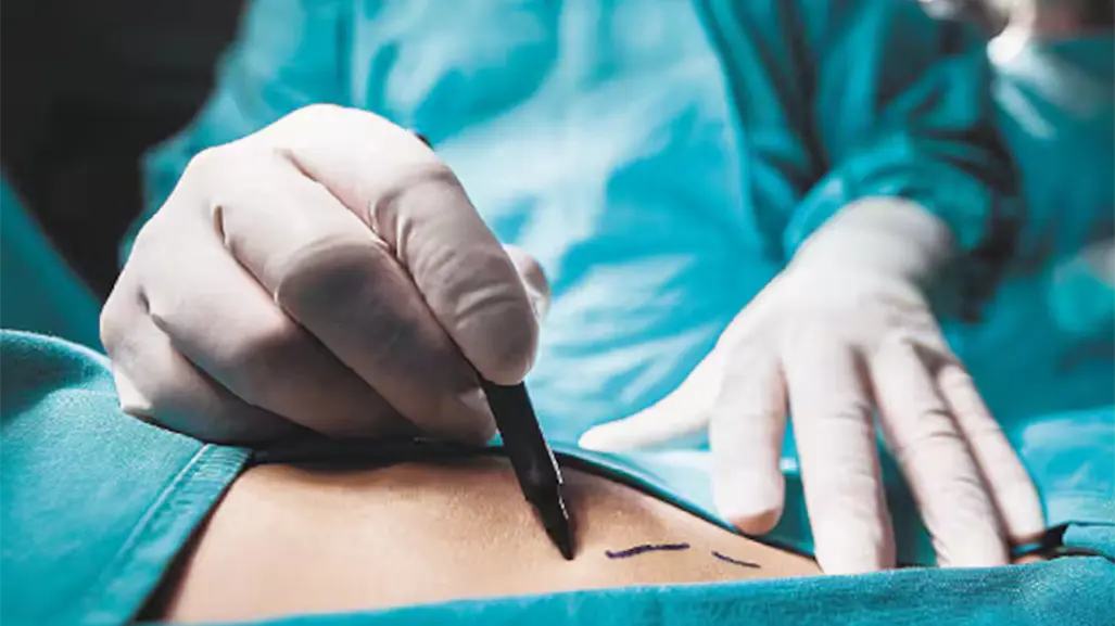 ¿Tu clínica estética está certificada? Alertan en Tamaulipas por cirugías en lugares sin licencia sanitaria