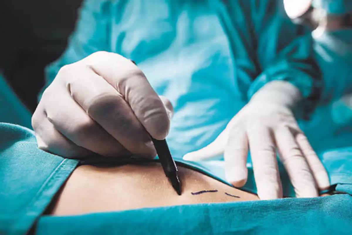 Solo 45 cirujanos plásticos y reconstructivos cuentan con certificación y cédula profesional vigentes para ejercer de manera segura. Foto: Freepik