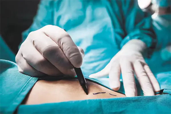 ¿Tu clínica estética está certificada? Alertan en Tamaulipas por cirugías en lugares sin licencia sanitaria