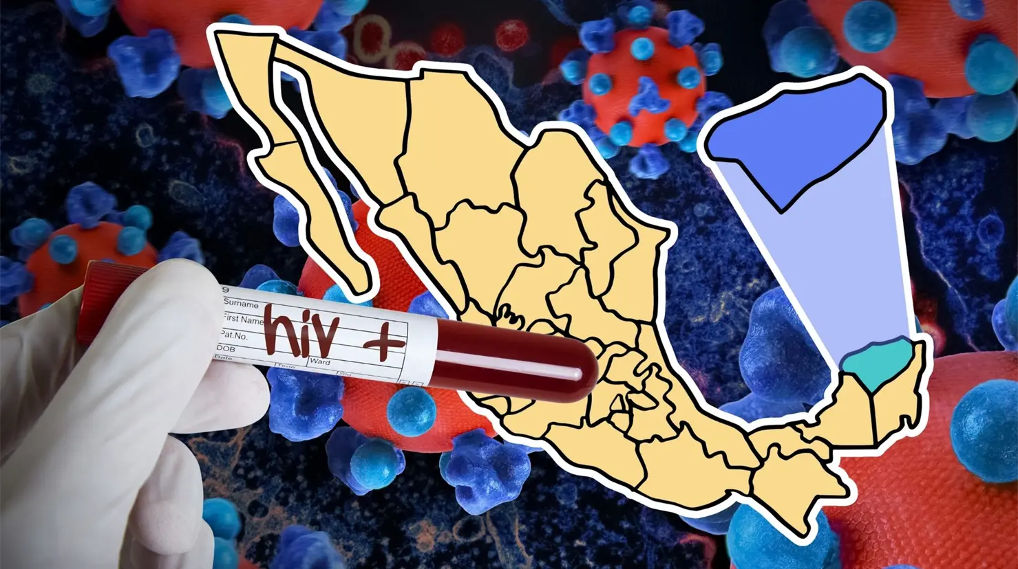 ¿Quiénes son los más afectados por el VIH en Yucatán?. Foto: CANVA / Adity Cupil