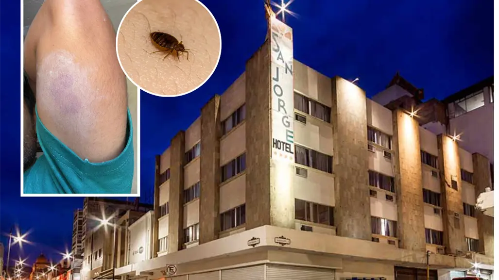 Hotel San Jorge en Saltillo infestado de chinches, denuncian turistas picaduras