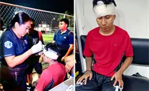 Gran susto en Kanasín por un futbolista que se pegó en un poste metálico: fue atendido a tiempo por paramédicos Gran susto en Kanasín por un futbolista que se pegó en un poste metálico: fue atendido a tiempo por paramédicos