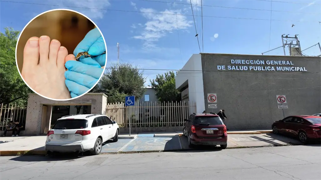 Ofrece Torreón servicios de podología a bajo costo, ¿a dónde puedes acudir?