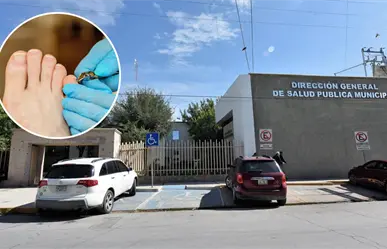 Ofrece Torreón servicios de podología a bajo costo, ¿a dónde puedes acudir?