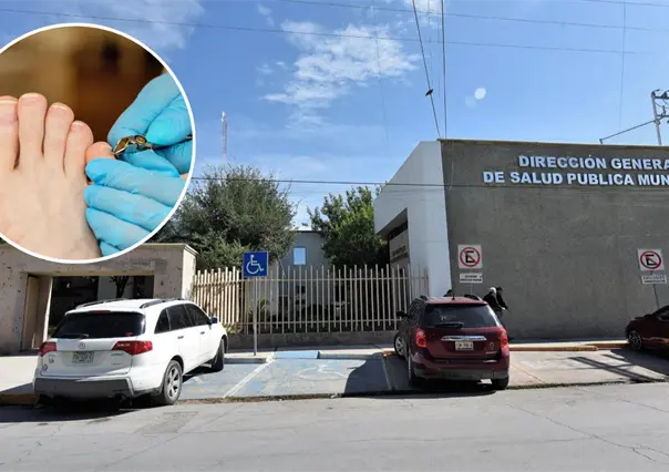 Ofrece Torreón servicios de podología a bajo costo, ¿a dónde puedes acudir?