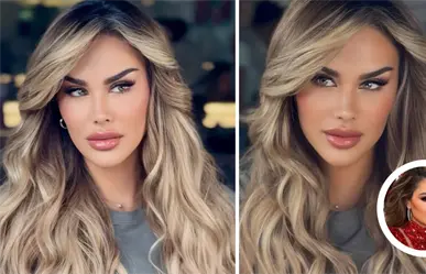Ninel Conde cambia el color de sus ojos ¿en qué consiste la cirugía y cuáles son sus riesgos?