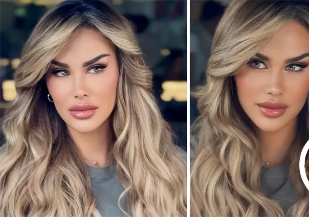 Ninel Conde cambia el color de sus ojos &iquest;en qu&eacute; consiste la cirug&iacute;a y cu&aacute;les son sus riesgos?