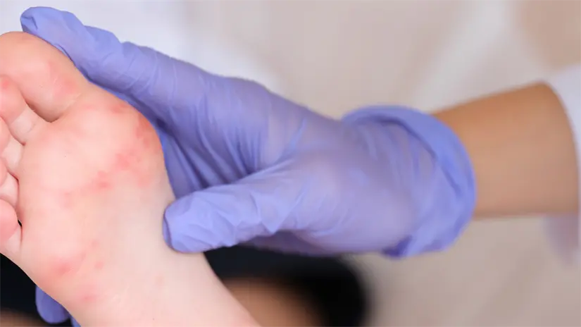 Foto ilustrativa: Canva.