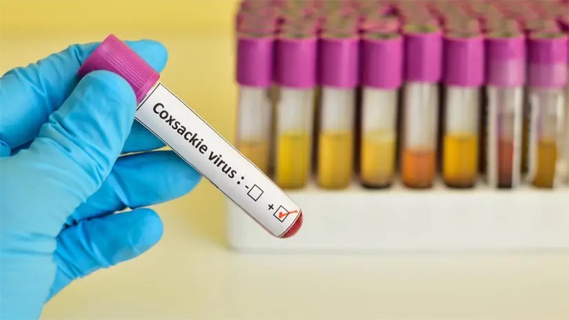 Foto ilustrativa: Canva.