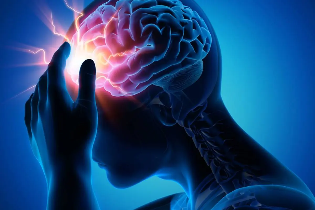 El ictus es un accidente cerebro vascular, comúnmente conocido como embolia o derrame. Foto: Ramón Sánchez