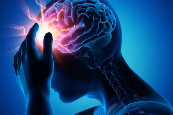 Ictus en Tamaulipas: señales de alerta que todos deben conocer, según los especialistas Ictus en Tamaulipas: señales de alerta que todos deben conocer, según los especialistas