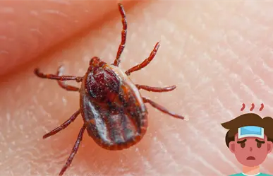 Niña de Durango muere semanas después de mordedura de garrapata y esto se sabe del caso