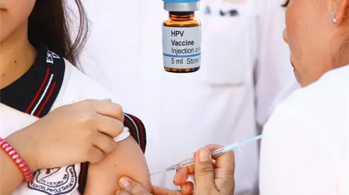 Vacuna contra VPH: ¿quiénes deben aplicarse una dosis?