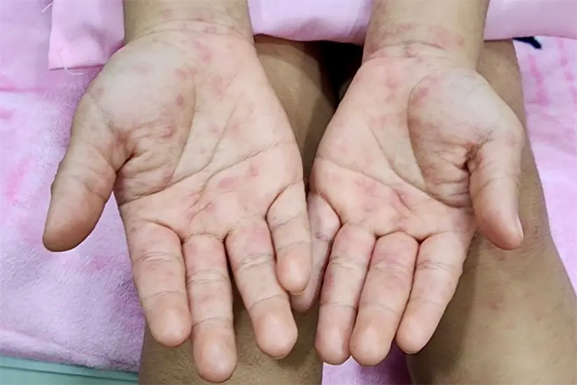 imagen recuadro Foto: Axel Hassel