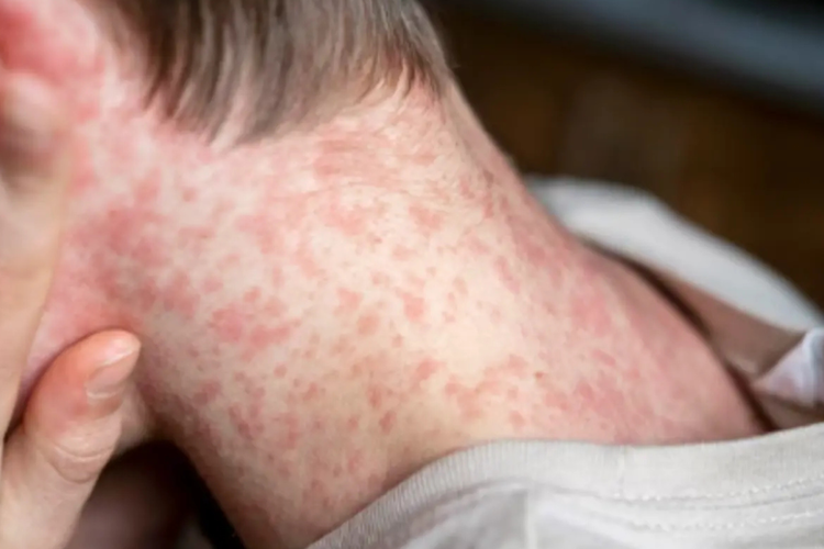 imagen-cuerpo imagen-cuerpo