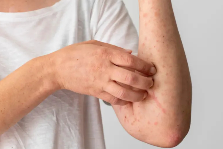 imagen-cuerpo imagen-cuerpo