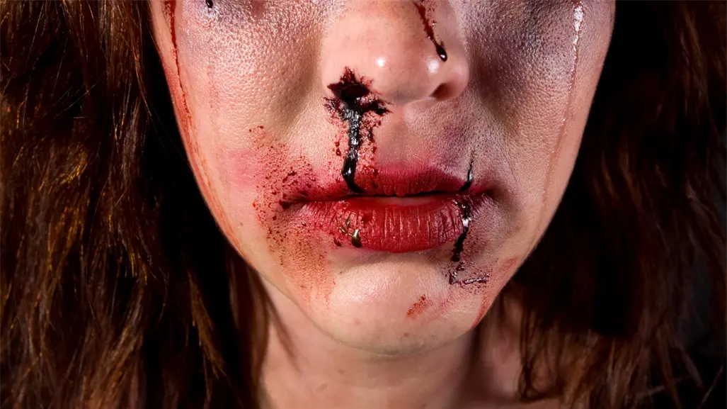 Mujer es golpeada por amigas tras presuntamente hablar con el exnovio de una y casi pierde un ojo