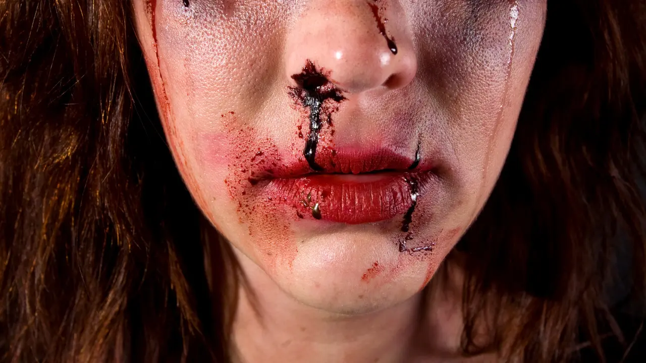 Melisa fue brutalmente golpeada en plena vía pública. Foto: Canva