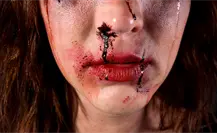 Mujer es golpeada por amigas tras presuntamente hablar con el exnovio de una y casi pierde un ojo Mujer es golpeada por amigas tras presuntamente hablar con el exnovio de una y casi pierde un ojo