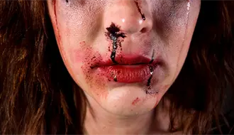 Mujer es golpeada por amigas tras presuntamente hablar con el exnovio de una y casi pierde un ojo