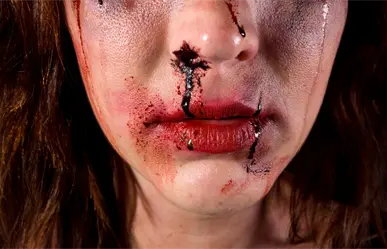 Mujer es golpeada por amigas tras presuntamente hablar con el exnovio de una y casi pierde un ojo