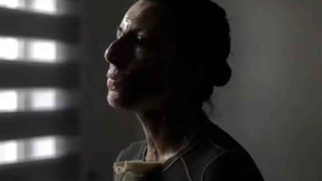 Thalía Martínez, víctima de una explosión por gas, enfrenta un largo proceso legal; su hermano Salvador denuncia la falta de responsabilidad de la empresa.